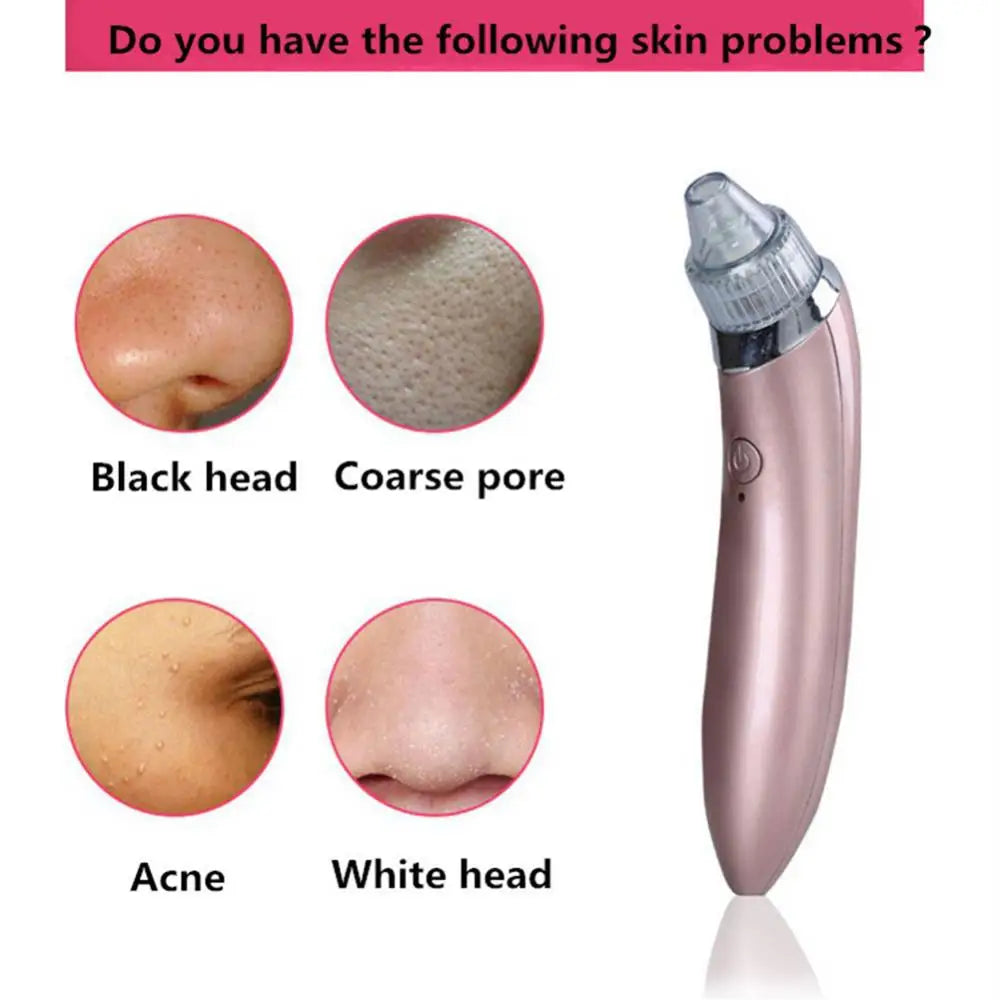 Acne Vacuum I  Skincare Exfoliating